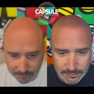 🔥 Effet rasé ultra naturel

Retrouvez l’apparence d’un crâne fraîchement rasé grâce à la tricopigme
