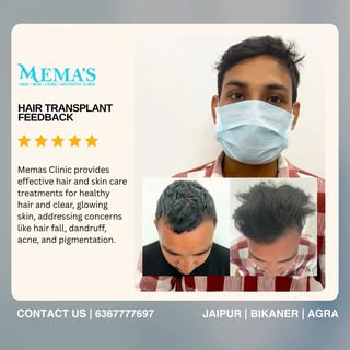 Real results, real confidence 🙌
Hair Transplant Feedback at Memas Clinic ✨
From hair fall to hair g