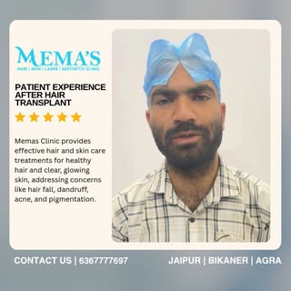 Real results, real confidence 🙌
Hair Transplant Feedback at Memas Clinic ✨
From hair fall to hair g
