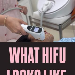 “Chill scenes & HIFU dreams ✨ While you relax, collagen gets to work.” 🤍
#HIFU #SkinTightening #Non