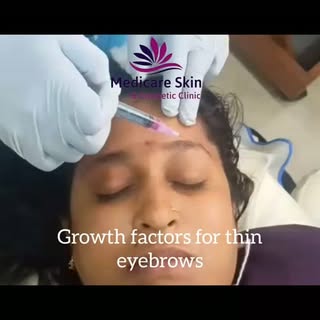 If your eyebrows have become thin due to over-plucking, aging, stress, or hormonal changes, growth f