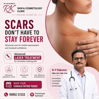 Don't let acne scars affect your confidence. Our advanced laser treatment is designed to help improv