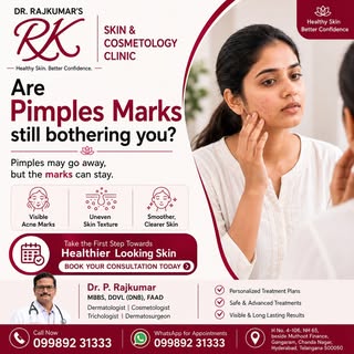 Are pimples gone, but the marks are still there?

Pimples may heal, but the marks can stay for a lon