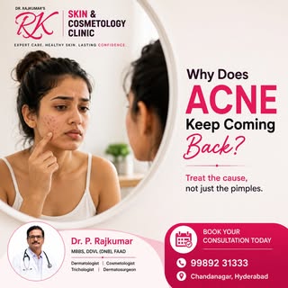 Why does acne keep coming back?

Acne isn't just about what you see on your skin. Understanding the 