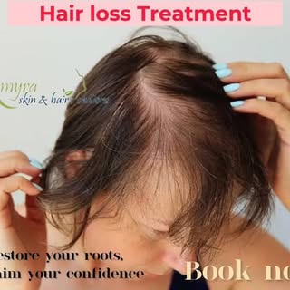 Hair loss Treatment