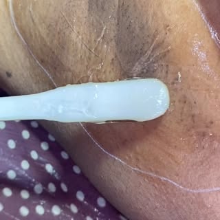 #drsoniamangal #myraskinhairsolutions #laser #laserhairremoval #unwantedhairremoval