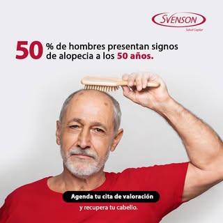 ¿Ha notado que tus entradas se ven más marcadas, tu cabello más delgado o zonas donde ya no crece ig