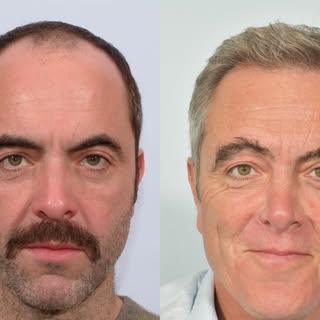 James Nesbitt’s ( @jamesnesbittofficial ) new Netflix thriller Run Away is topping the charts, but v