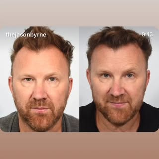 ‘Beautiful hair’ Jason Byrne. Looking well. 6 month check-up at Samson House this week.