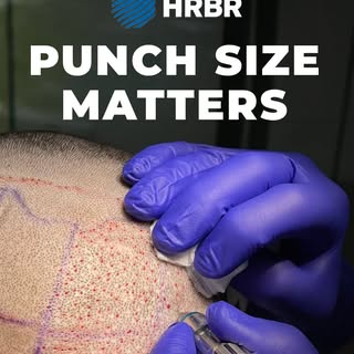Smaller isn't always better. 👇

Some clinics market "ultra-small punches" — as tiny as 0.5 mm — as 