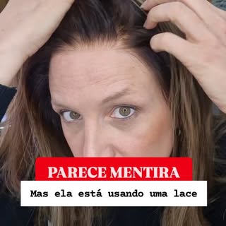A Giovana enfrentou um dos momentos mais delicados da sua vida: a perda de cabelo durante o tratamen