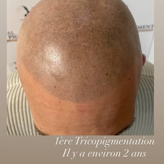 AL PIGMENT
Tricopigmentation Capillaire
📍Le Havre📍

📞 06.66.41.87.16
🌏 www.al-pigment.fr
📧 cont