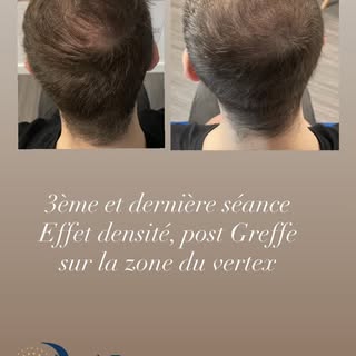 AL PIGMENT
Tricopigmentation Capillaire
📍Le Havre📍

📞 06.66.41.87.16
🌏 www.al-pigment.fr
📧 cont