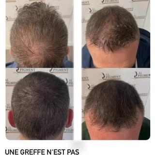 AL PIGMENT
Tricopigmentation Capillaire
📍Le Havre📍

📞 06.66.41.87.16
🌏 www.al-pigment.fr
📧 cont