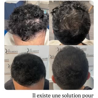 AL PIGMENT
Tricopigmentation Capillaire
📍Le Havre📍

📞 06.66.41.87.16
🌏 www.al-pigment.fr
📧 cont