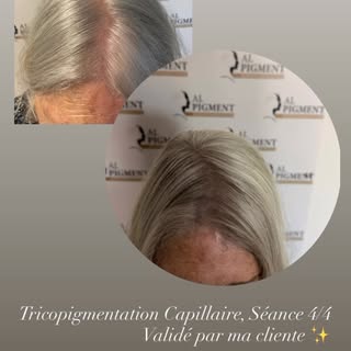AL PIGMENT
Tricopigmentation Capillaire
📍Le Havre📍

📞 06.66.41.87.16
🌏 www.al-pigment.fr
📧 cont