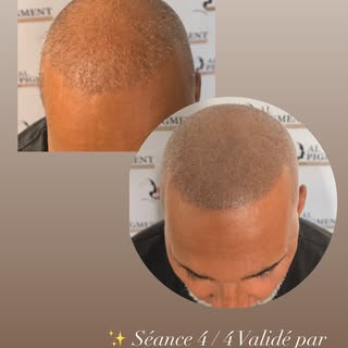 AL PIGMENT
Tricopigmentation Capillaire
📍Le Havre📍

📞 06.66.41.87.16
🌏 www.al-pigment.fr
📧 cont