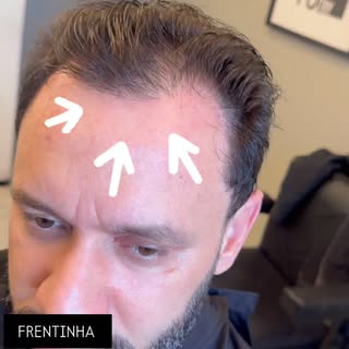 Você está assim ?