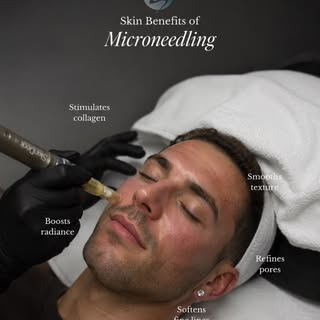 Your skin has the ability to renew itself✨

SkinPen® Microneedling stimulates your body’s natural co