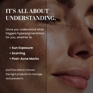 Hyperpigmentation isn't just about treating dark spots it's about understanding what causes them. ✨
