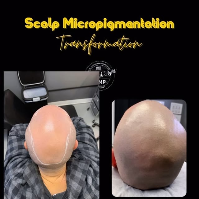 Results that only he would know he got a scalp tattoo!🔥⁠
We customize your treatment to give you a 
