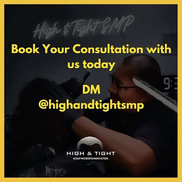 ✅Hair loss or thinning of the crown
✅Recession in your hairline 
✅SMP is great for men and women 

�