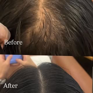 ✨KSM은 하나하나 세심한 고객 컨설팅을 통해 고객의 정확한 니즈를 파악하고, 전문가로서 어떤 방식과 기술을 적용할지 결정해요 
어떤 기법을 사용할지는 ( Scatter SMP ,