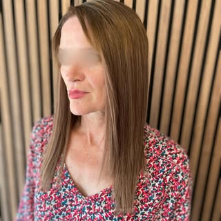 Today’s Hair in Recovery Transformation 🤩

Swipe for Before 👉🏼