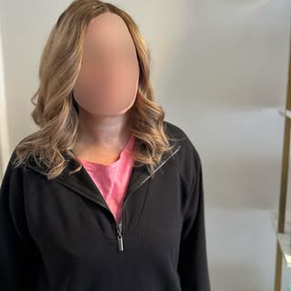 Hair in Recovery Post Chemotherapy 🤍 

Swipe for Before 👉🏼