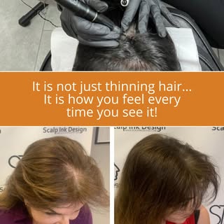Thinning hair is not just a “hair problem,” it is a confidence problem.

If you find yourself adjust