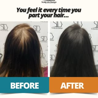 Noticed your part line getting wider? Avoiding certain hairstyles? You are not alone.

Thinning hair