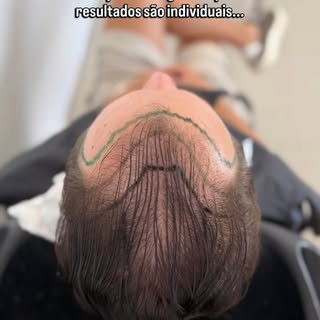 Há algo especial quando o paciente também é médico.

Ele conhece as limitações da cirurgia, sabe que