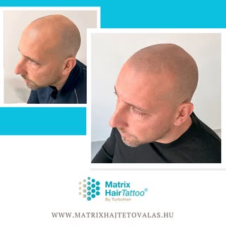 👌😉🤩 A hajtetoválás nem csupán a fejbőr fedését biztosítja, hanem az arc karakterét is jelentősen 