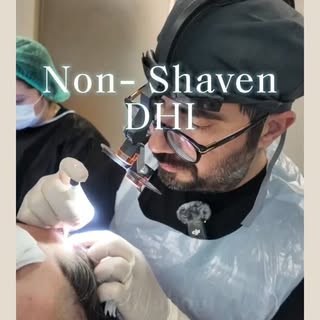 Precision over shortcuts.

In classical hair transplantation, channels are opened first and the area
