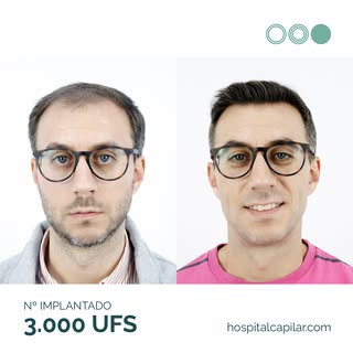 INCREIBLE CAMBIO EN TAN SOLO 6 MESES 🤯

Hace 6 meses que Daniel decidió ponerse en manos de profesi