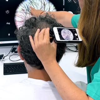 🔬 ¿Qué ve un cirujano capilar cuando pasa el tricoscopio?

🩺 Mucho más de lo que parece a simple v