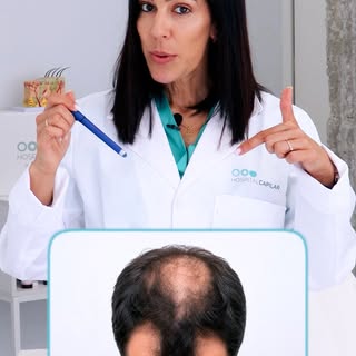 ¿Qué tratamiento necesitas según tu grado de alopecia? Nuestra doctora Amaro te lo explica. 

No tod