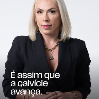 Algumas pessoas fazem dois, três e até mais transplantes ao longo da vida.

E, na maioria das vezes,