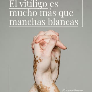 El vitíligo es mucho más que manchas blancas. 🤍

Es una enfermedad autoinmune crónica que provoca l
