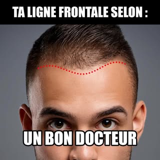 Entre attentes, rêves et réalités, trouver la ligne frontale idéale n'est pas une mince affaire ! 😅