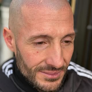 Un résultat 100% personnalisé aujourd’hui avec un travail en effet rasé avec une micropigmentation c