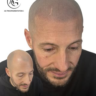 Anthony est venu au studio avec une idée simple : avoir l’air bien… sans que ça se remarque.

Ici, o