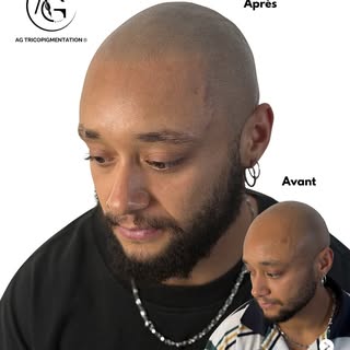 Joshua a perdu ses cheveux bien plus tôt qu’il ne l’aurait imaginé.

Pendant des années, il a dû s’h