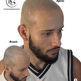 AVANT / APRÈS ABAISSEMENT DE LIGNE FRONTAL ET DENSIFICATION 🪄

Paco avait depuis son plus jeune âge