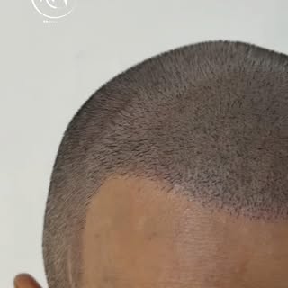 Nuno est arrivé avec un sentiment que beaucoup connaissent :
se regarder dans le miroir et remarquer