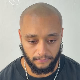 Il y a des histoires qui marque et celle de Joshua particulièrement.

Perdre sa ligne frontale très 