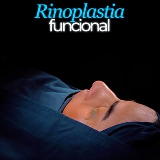 Respirar mejor también transforma tu calidad de vida. ✨

En una rinoplastia funcional no solo buscam