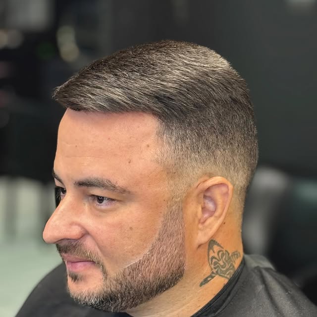 A prótese capilar vai além da estética, é uma oportunidade de recuperar o brilho e a confiança que p