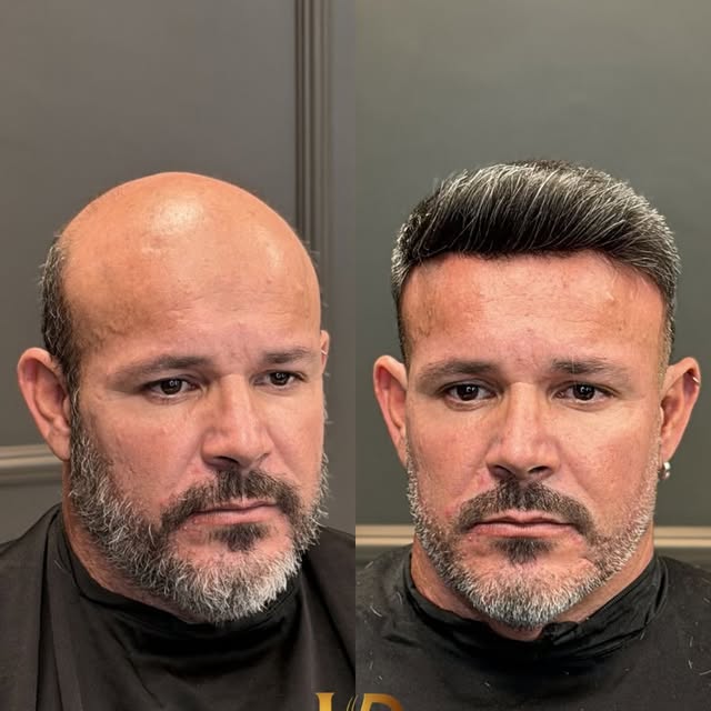 Sinta a satisfação de um novo visual, a Prótese Capilar te trás várias possibilidades e pode ajudar 