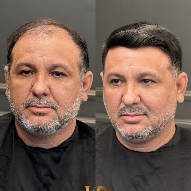 Não é apenas sobre cabelo… é sobre imagem, presença e confiança.
O antes revela o que muitas vezes é